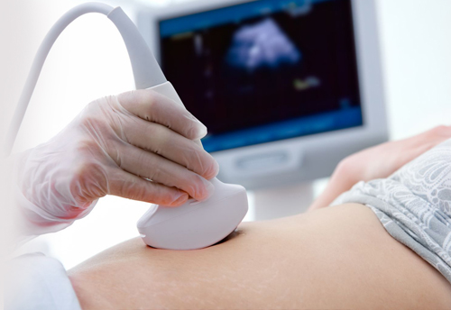 sonno1 سونوگرافی