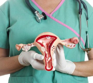 کیست تخمدان