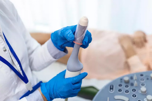 سونوگرافی واژینال