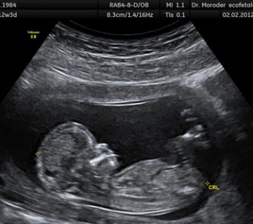 Biophysical ultrasound